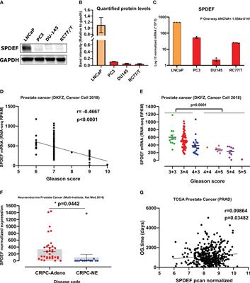 Regulation of SPDEF expression by DNA methylation in advanced prostate cancer